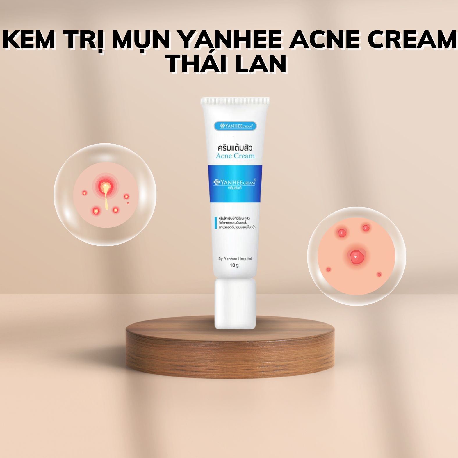 Kem Trị Mụn Yanhee Acne Cream Thái Lan-2