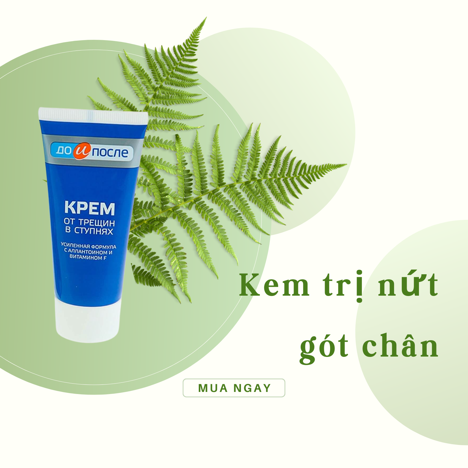 Kem trị nứt gót chân Kpem Nga-2
