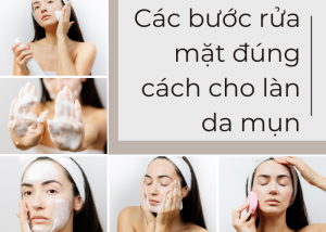 Các bước rửa mặt đúng cách cho làn da mụn