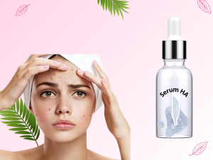 Vì sao dùng Serum HA lên mụn, nguyên nhân ít ai ngờ tới