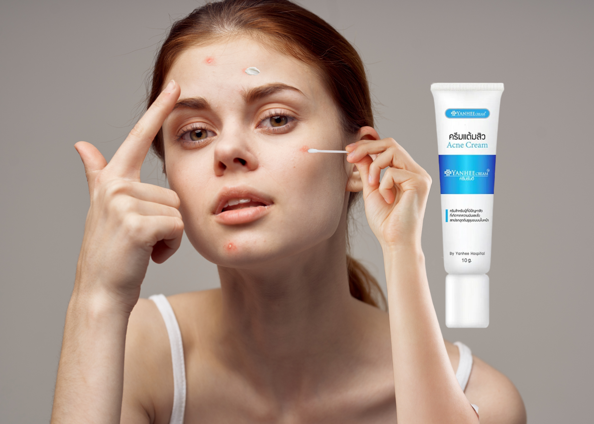 Kem Trị Mụn Yanhee Acne Cream Thái Lan Dưỡng Da Mặt-1